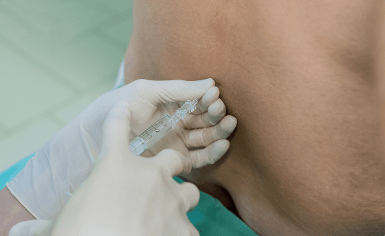 Epidural Steroid Injections