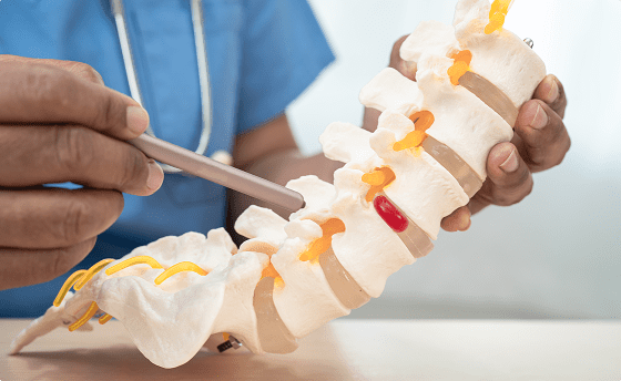 Spinal Cord Stimulation